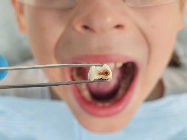 Best Emergency Denture Repair in Round Rock, TX